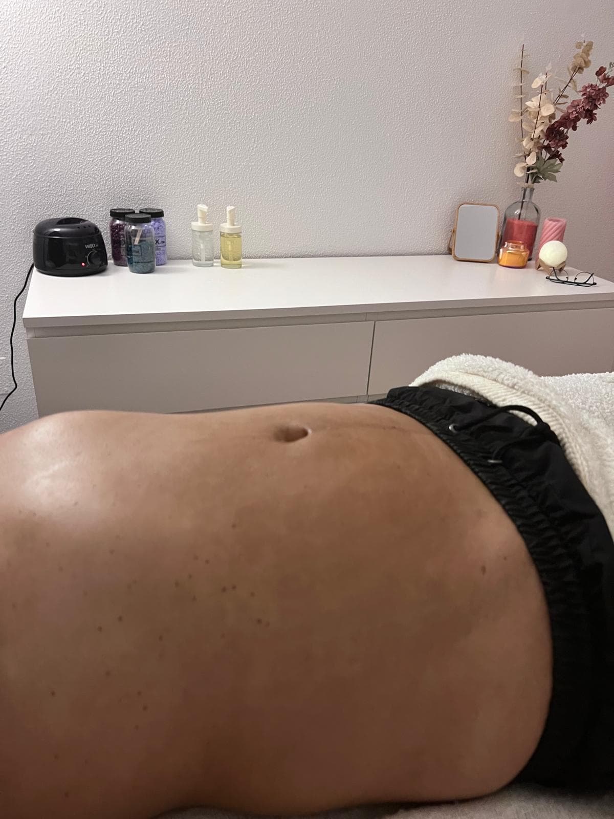 Drenagem Linfática — Depois